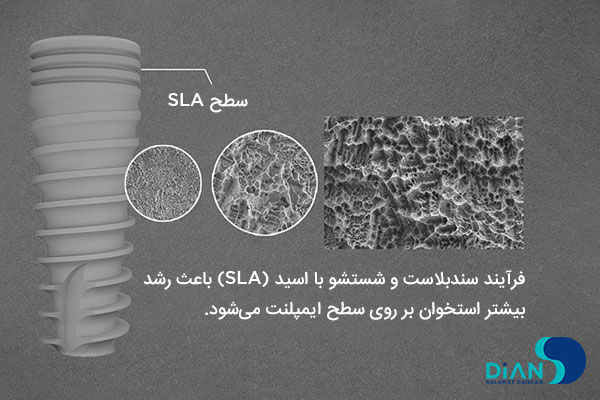 زبری سطح ایمپلنت دندان