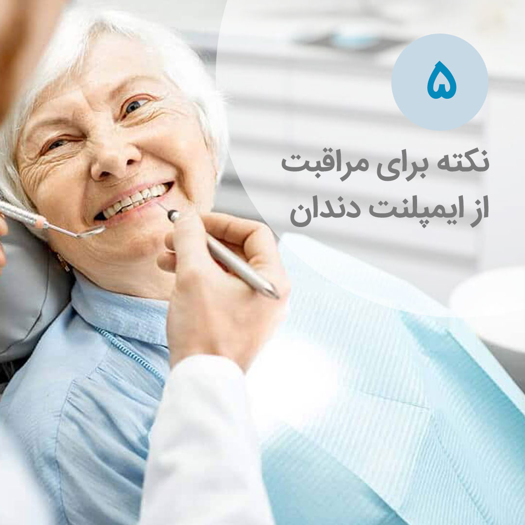 مراقبت از ایمپلنت دندان تنها با ۵ نکته مراقبت از ایمپلنت دندان