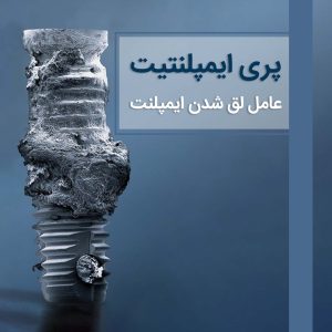 پری ایمپلنتیت