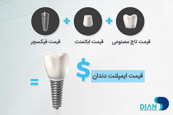 قیمت ایمپلنت دندان