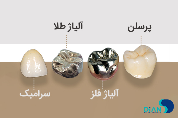 متریال تاج مصنوعی دندان