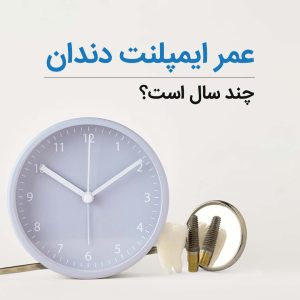 عمر ایمپلنت دندان