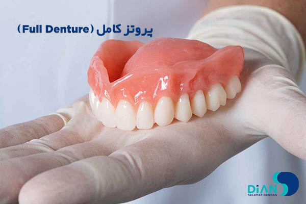 پروتز کامل (Full Denture)