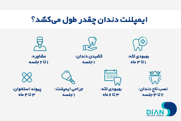 عوامل کلیدی که بر مدت زمان ایمپلنت دندان 