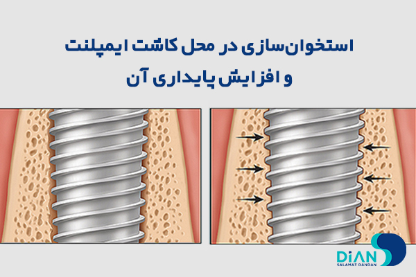 استخوان سازی