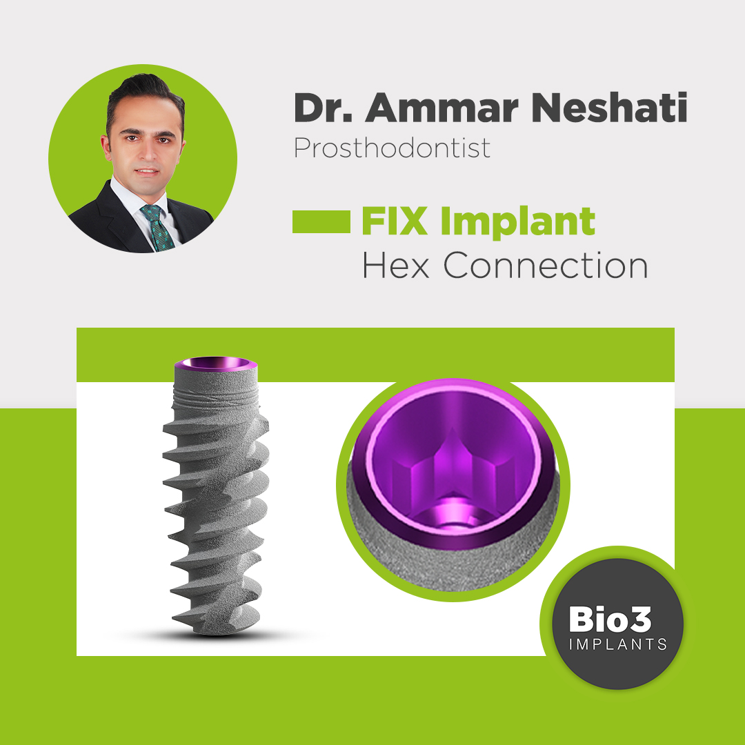 توضیحات آقای دکتر عمار نشاطی در مورد کانکشن هگز در ایمپلنت فیکس دکتر عمار نشاطی