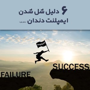 ۶ دلیل اصلی شل شدن ایمپلنت دندان (بخش اول) دلیل اصلی شل شدن ایمپلنت دندان