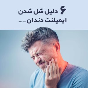 ۶ دلیل اصلی شل شدن ایمپلنت دندان (بخش دوم) دلیل اصلی شل شدن ایمپلنت دندان