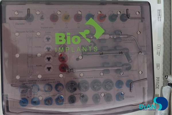 Implantation in Molar Area