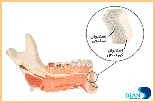 نقش سرعت دریلینگ در موفقیت ایمپلنت دندان