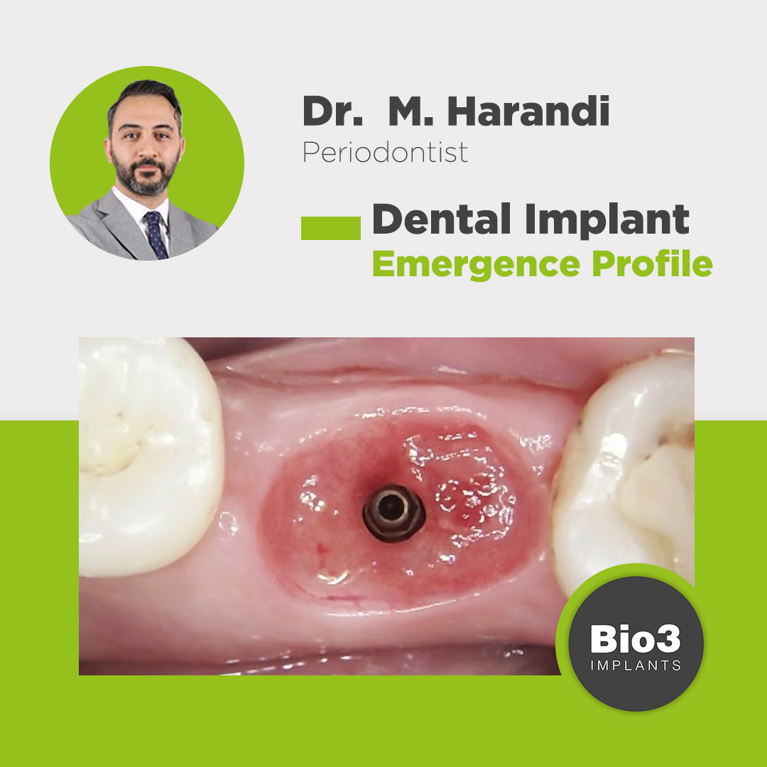 توضیحات آقای دکتر محمد هرندی در مورد اهمیت امرجنس پروفایل در کاشت ایمپلنت دکتر محمد هرندی