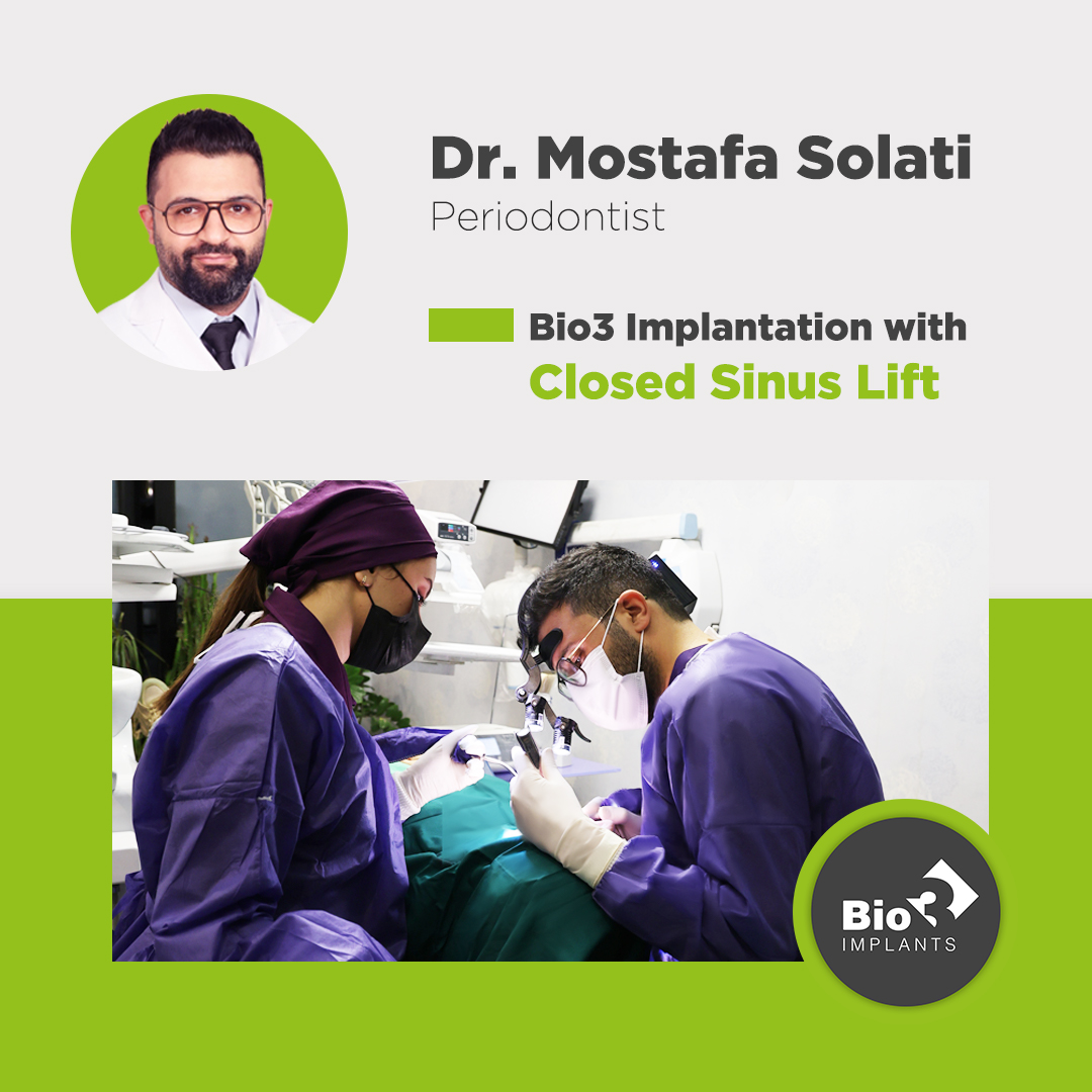 توضیحات دکتر مصطفی صولتی در مورد کاشت ایمپلنت با سینوس لیفت کاشت ایمپلنت با سینوس لیفت