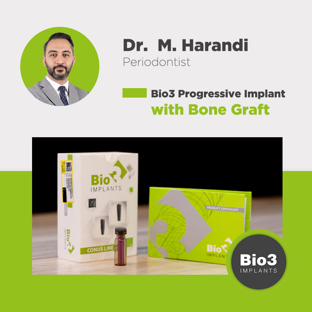توضیحات دکتر محمد هرندی در مورد کاشت ایمپلنت با پیوند استخوان کاشت ایمپلنت با پیوند استخوان