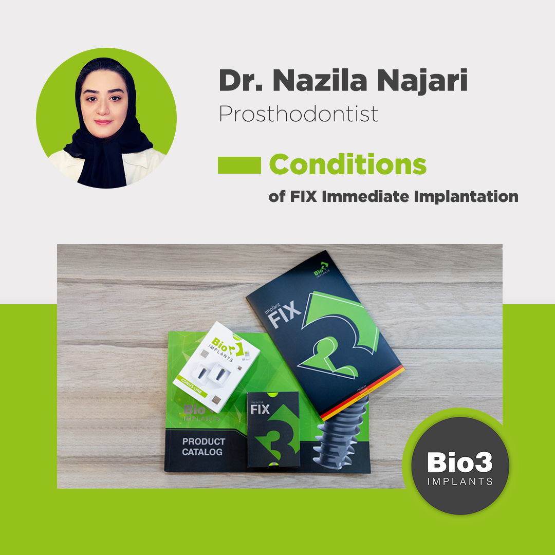 شرایط کاشت ایمپلنت فوری