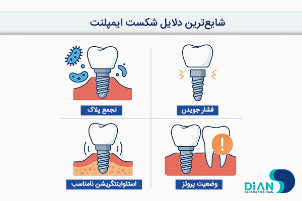 شایعترین دلایل شکست ایمپلنت