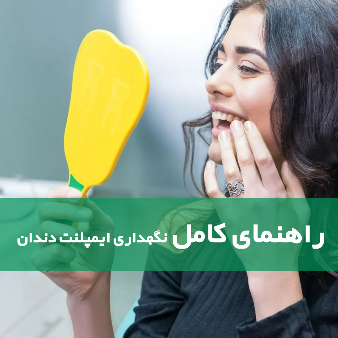راهنمای کامل نگهداری ایمپلنت دندان برای ماندگاری بیشتر آن
